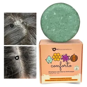 Shampoo Anticaspa Natural P/ Dermatite, Psoríase, Seborreica